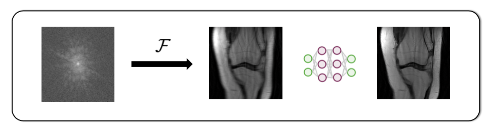 Mri Recon Deblurring