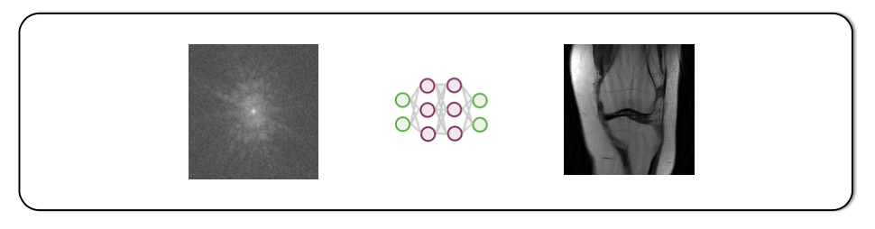 Mri Recon Transform Learning